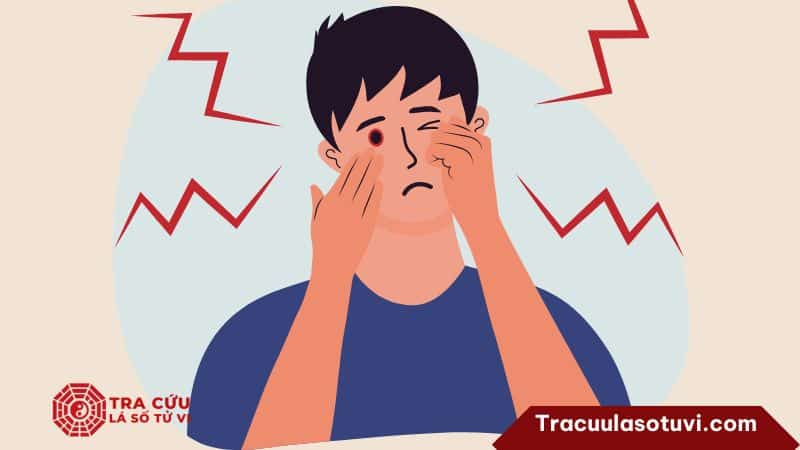 Thái Dương hãm địa ở cung Tật Ách chủ về các vấn đề liên quan đến mắt Thái Dương hãm địa ở cung Tật Ách chủ về các vấn đề liên quan đến mắt